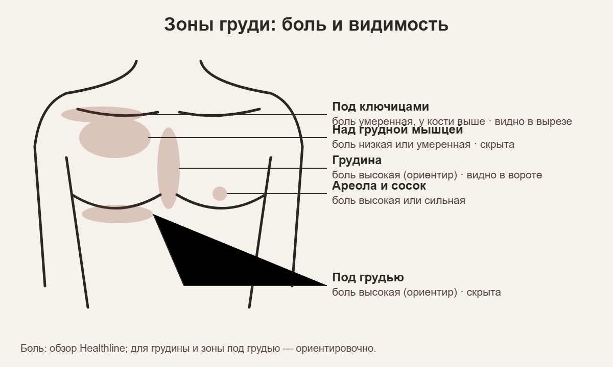 Схема зон груди для тату: под ключицами, над мышцей, грудина, ареола, под грудью — боль и видимость